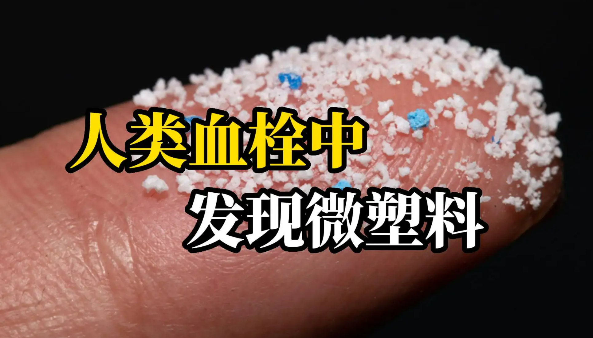 震驚！人類血栓中首次發(fā)現(xiàn)微塑料！